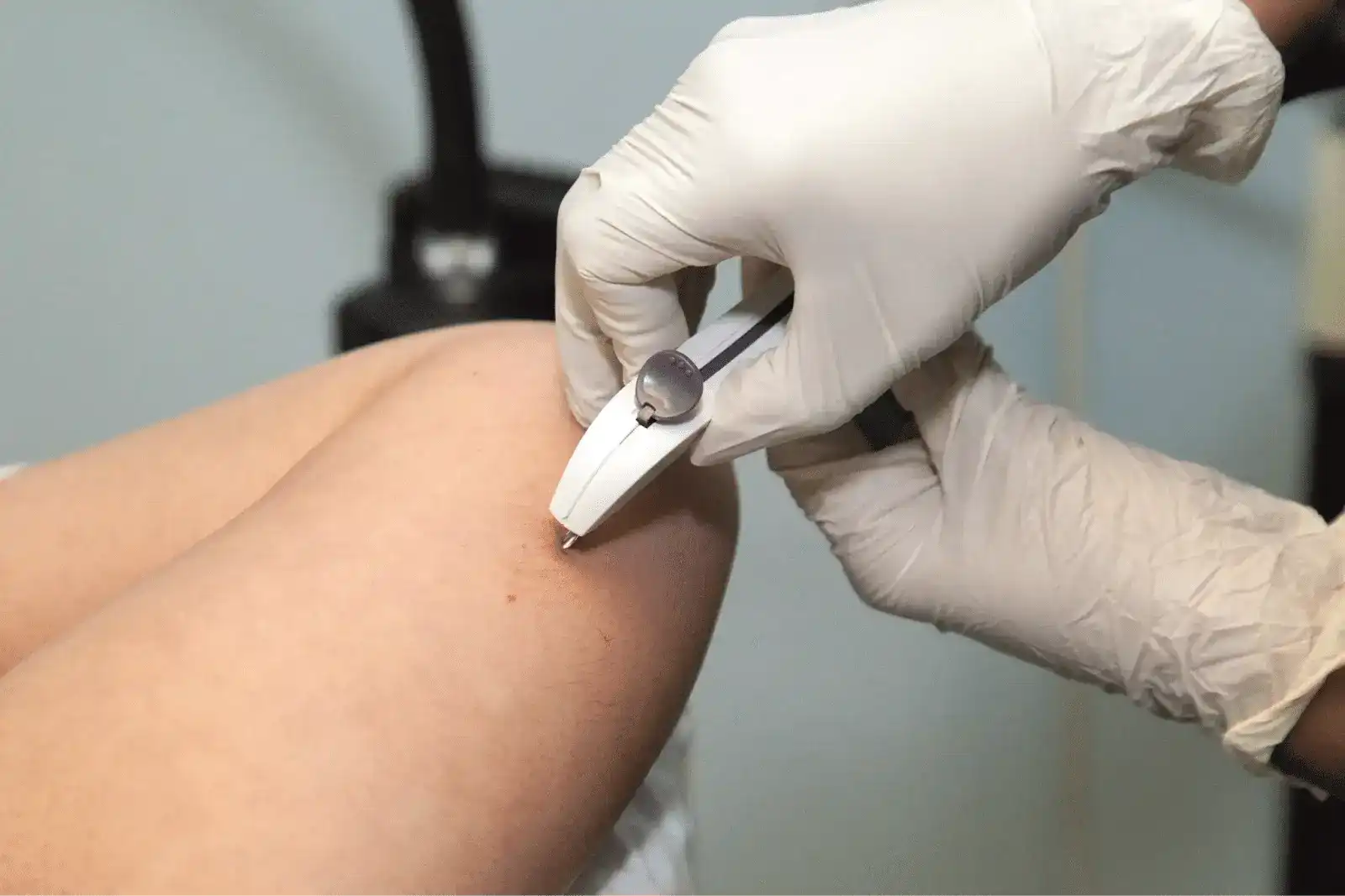 signs-nexplanon-is-wearing-off-med-supply-solutions